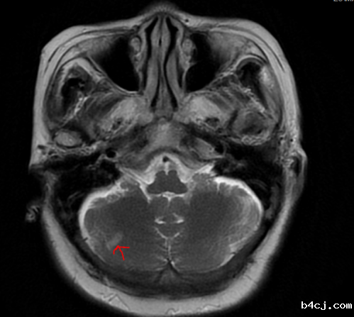 1619155245876241.png 图片1.png